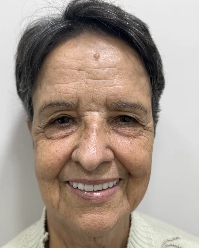 Rosto de a paciente depois do tratamento, sorrindo
