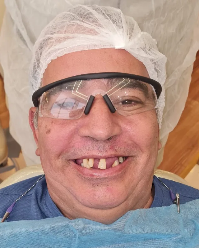 Rosto de o paciente antes do tratamento, sorrindo