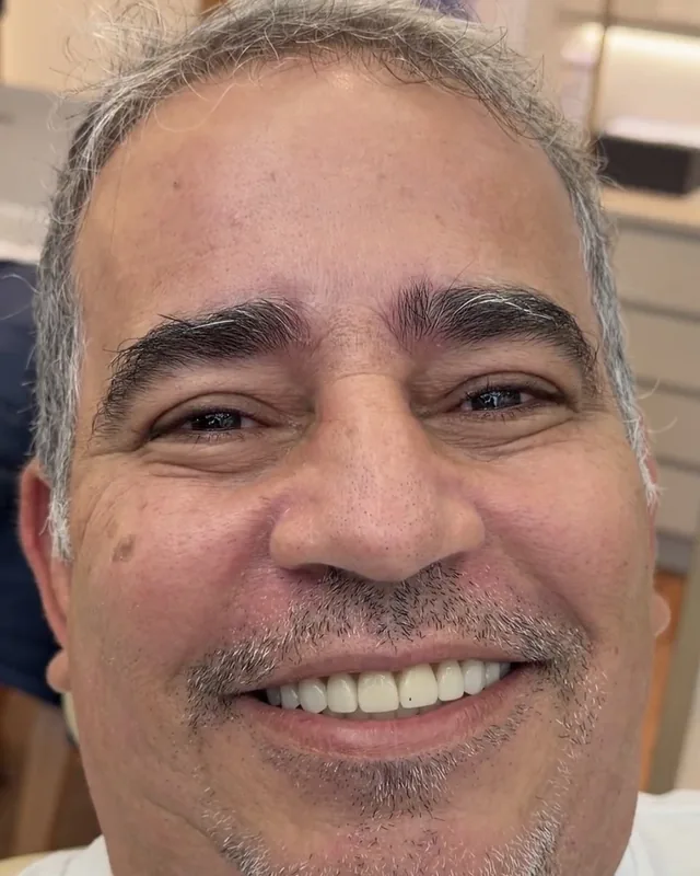 Rosto de o paciente depois do tratamento, sorrindo