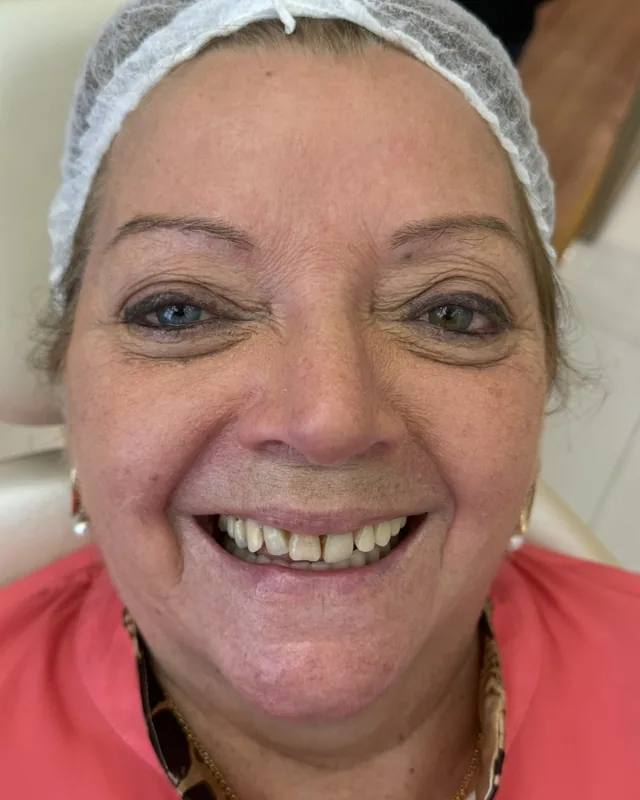 Rosto de a paciente antes do tratamento, sorrindo